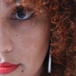 Melasma o que existe por trás